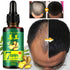 🤩 7 DAYS GINGER GERMINAL OIL | HAIR REGROWTH OIL 🧪 | 30ml 🧪