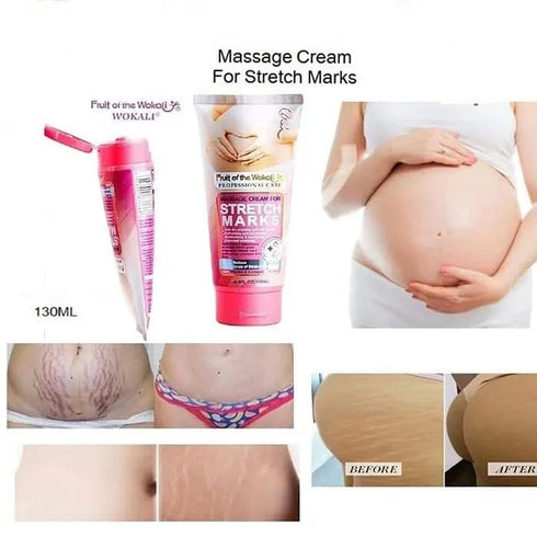 Upto 60% OFF | Wokali Stretch Marks Cream For Men's & Women's