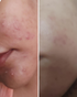 Vitamin C & E Serum | 50% Off with Free Cash on Delivery