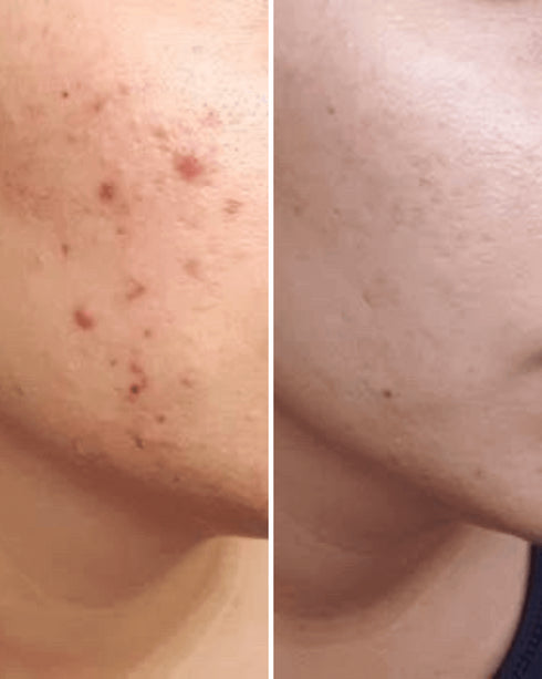 Vitamin C & E Serum | 50% Off with Free Cash on Delivery