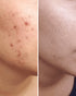 Vitamin C & E Serum | 50% Off with Free Cash on Delivery
